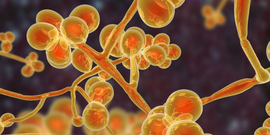 Drug -resistant fungus spreads rapidly in hospitals