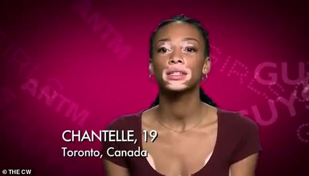 Winnie Harlow (then Chantelle Brown-Young) on ANTM, spotlighting vitiligo awareness