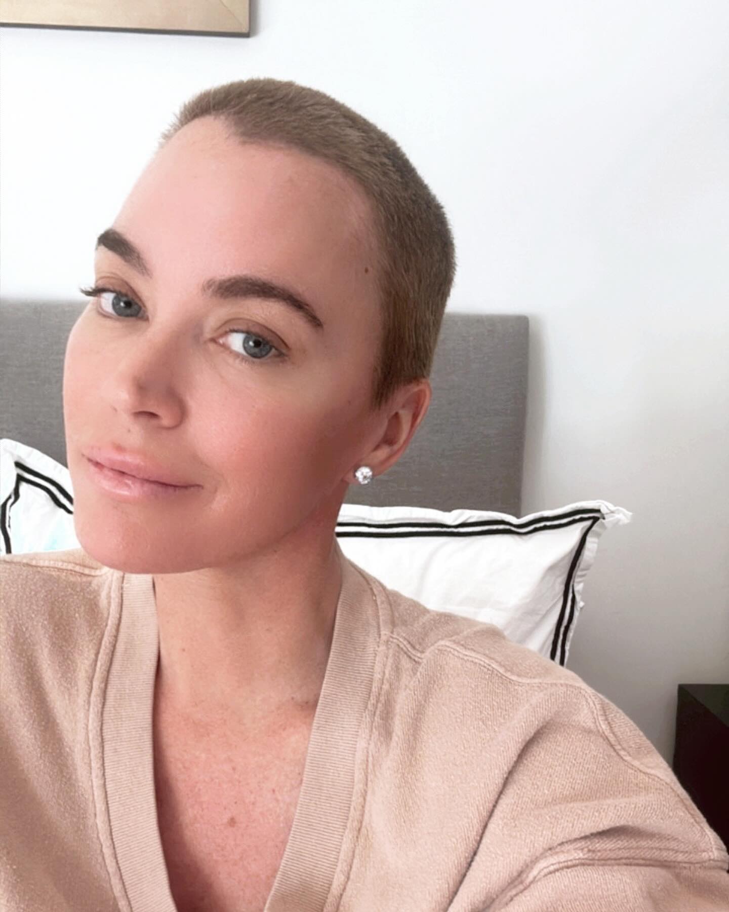 Teddi Mellencamp with a buzz cut after melanoma treatment.