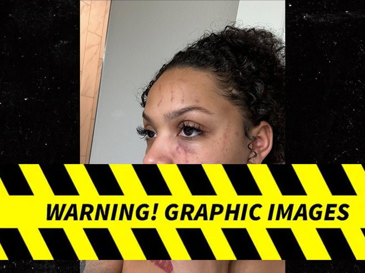 Images shared by ex-girlfriend Dacoda Jones alleging injuries; claims are unproven and have not been adjudicated.