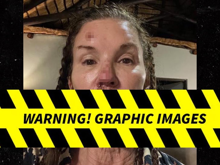 Alleged injury photos of Janice Dickinson showing scabbing on her forehead, nose, lips, and chin after a reported fall while filming I'm a Celebrity... South Africa in 2022.