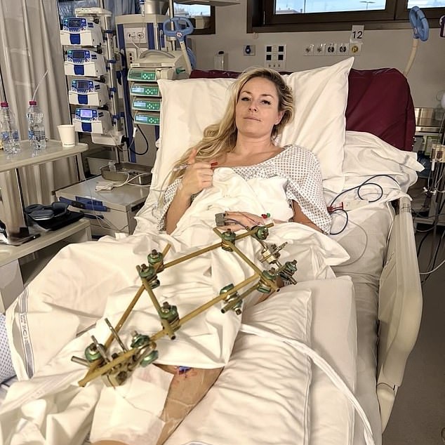 Lindsey Vonn had a fourth operation on her broken leg in hospital in Italy on Saturday - DailyMailUS