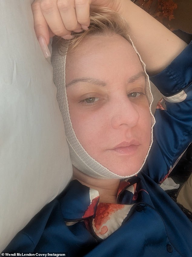 Wendi McLendon-Covey shares a recovery selfie with a neck bandage after her neck lift, explaining why she skipped the Oscars reunion.