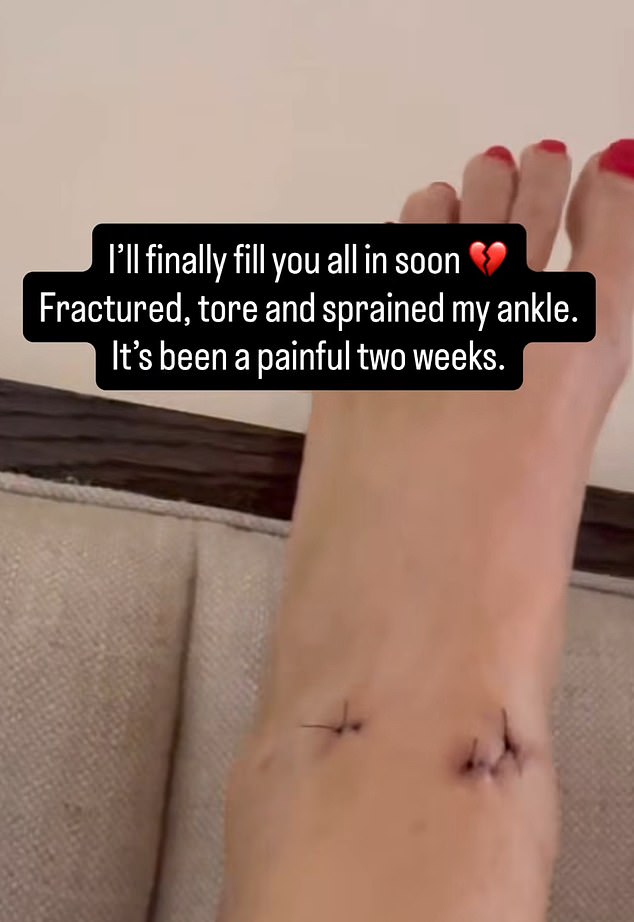 Nikki Garcia shared a close-up of her injured ankle on social media.